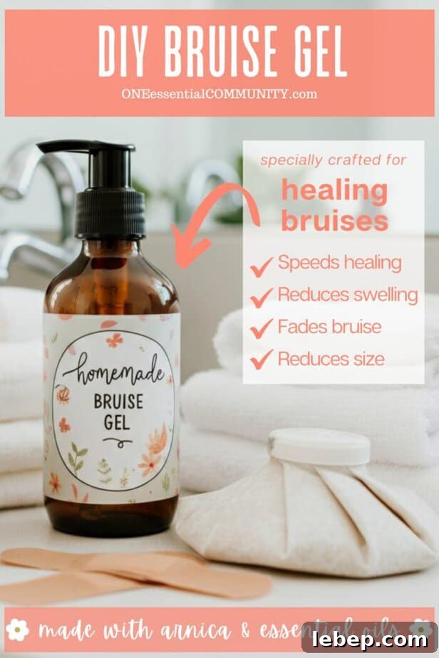 DIY Arnica and Essential Oil Gel for Bruises: Faster Healing Formula 4 DIY Bruise Gel bottle with ice pack and supplies